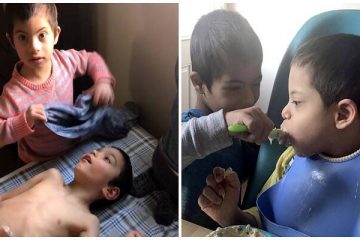 Παιδί 4 ετών με Σύνδρομο Down φροντίζει τα τρία ανάπηρα αδέλφια του και συγκινεί το διαδίκτυο