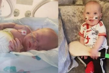 Μαχητής της ζωής: Μωράκι που δεν θα επιβίωνε στον τοκετό σήμερα είναι 10 μηνών και πάει σπίτι του για 1η φορά