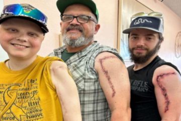 Μπαμπάς και αδερφός έκαναν τατουάζ την ουλή του μικρού γιου της οικογένειας που έχει καρκίνο