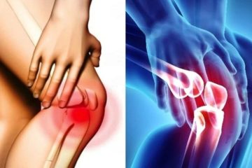 Ο πόνος στο γόνατο μπορεί να είναι σημάδι έλλειψης αυτής της βιταμίνης